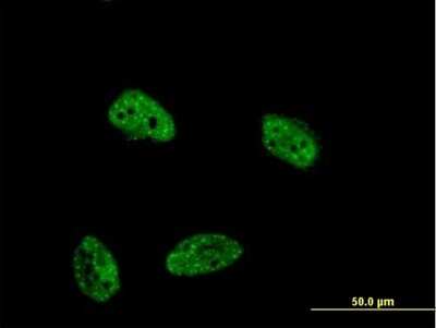 Immunocytochemistry/ Immunofluorescence: DUSP4 Antibody (1D12) [H00001846-M08]