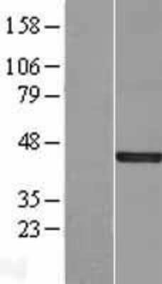 Western Blot: DUSP5 Overexpression Lysate [NBL1-10056]