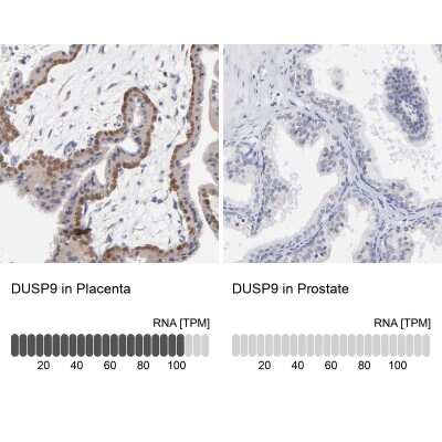 Immunohistochemistry-Paraffin: DUSP9 Antibody [NBP1-82641]