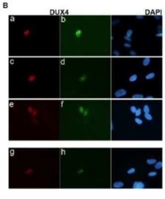 Immunocytochemistry/ Immunofluorescence: DUX4 Antibody (P4H2) - BSA Free [NBP1-49552]