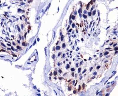 Immunohistochemistry: DUX4 Antibody (P4H2) - BSA Free [NBP1-49552]