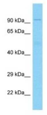 Western Blot: DUX4 Antibody [NBP3-10390]