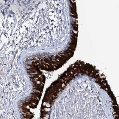 Immunohistochemistry-Paraffin: DYDC2 Antibody [NBP1-88778]