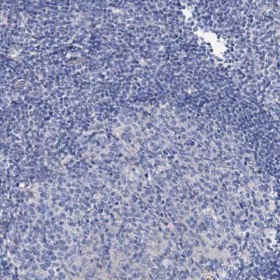 Immunohistochemistry-Paraffin: DYDC2 Antibody [NBP1-88778]