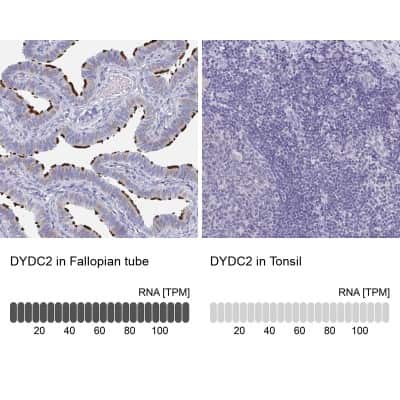 Immunohistochemistry-Paraffin: DYDC2 Antibody [NBP2-38377]