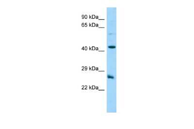 Western Blot: DYNAP Antibody [NBP2-82937]