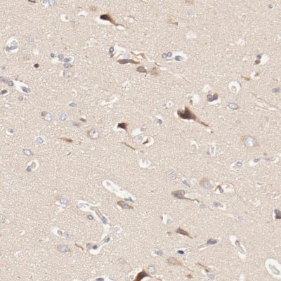 Immunohistochemistry-Paraffin: DYNC1H1 Antibody [NBP1-84254]