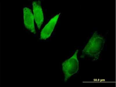 Immunocytochemistry/ Immunofluorescence: DYNC1I2 Antibody [H00001781-B01P]
