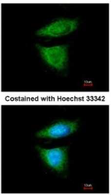 Immunocytochemistry/ Immunofluorescence: DYNC1I2 Antibody [NBP1-31703]