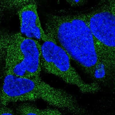 Immunocytochemistry/ Immunofluorescence: DYNC1I2 Antibody [NBP2-38469]