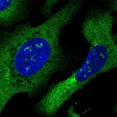 Immunocytochemistry/ Immunofluorescence: DYNC1I2 Antibody [NBP2-38714]