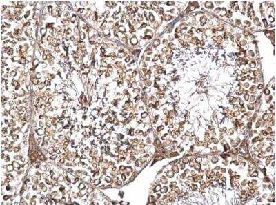 Immunohistochemistry-Paraffin: DYNC1I2 Antibody [NBP1-31703]