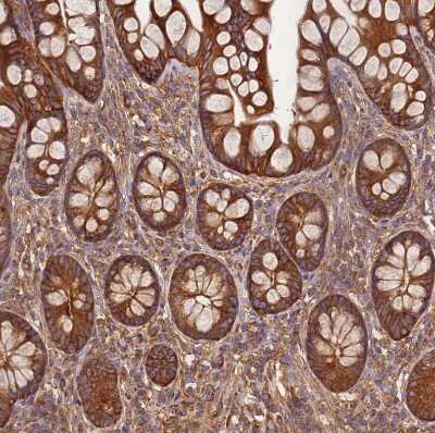 Immunohistochemistry-Paraffin: DYNC1I2 Antibody [NBP2-38469]