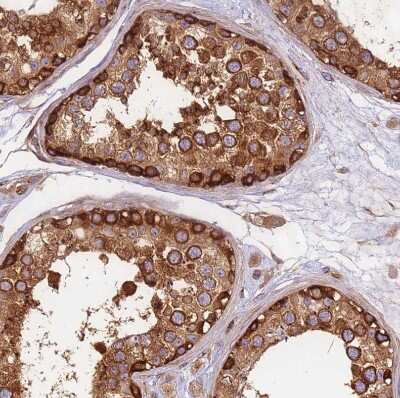 Immunohistochemistry-Paraffin: DYNC1I2 Antibody [NBP2-38469]