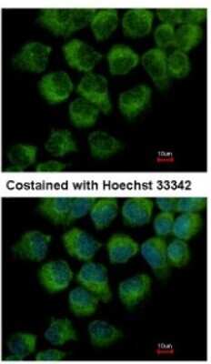 Immunocytochemistry/ Immunofluorescence: DYNC1LI1 Antibody [NBP2-14935]