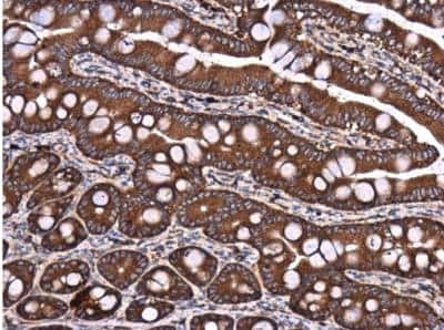 Immunohistochemistry-Paraffin: DYNC1LI1 Antibody [NBP2-14935]