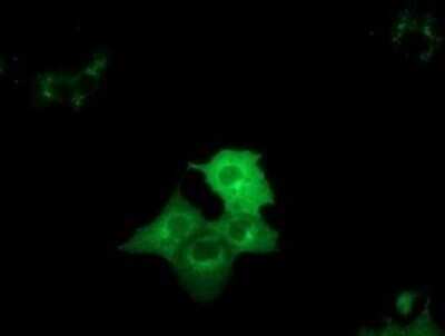 Immunocytochemistry/ Immunofluorescence: DYNC1LI1 Antibody (OTI2E8) - Azide and BSA Free [NBP2-71904]