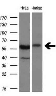 Western Blot: DYNC1LI1 Antibody (OTI2E8) [NBP2-45682]