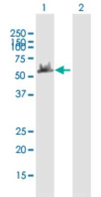 Western Blot: DYNC1LI2 Antibody [H00001783-B01P]