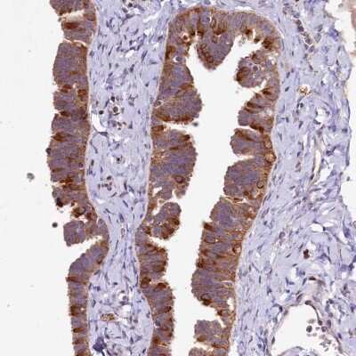 Immunohistochemistry: DYNC2H1 Antibody [NBP2-38437]