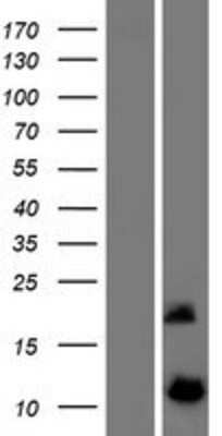 Western Blot: DYNLRB2 Overexpression Lysate [NBP2-05721]