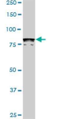 Western Blot: DYRK1A Antibody (7D10) [H00001859-M01]