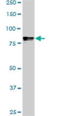 Western Blot: DYRK1A Antibody (7D10) [H00001859-M01]