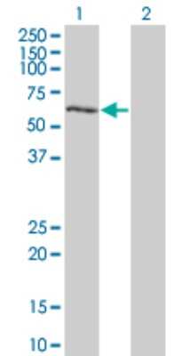 Western Blot: DYRK2 Antibody (4G11) [H00008445-M03]