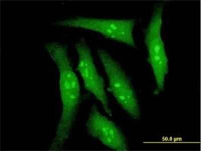 Immunocytochemistry/ Immunofluorescence: DYRK2 Antibody (6E2) [H00008445-M02]