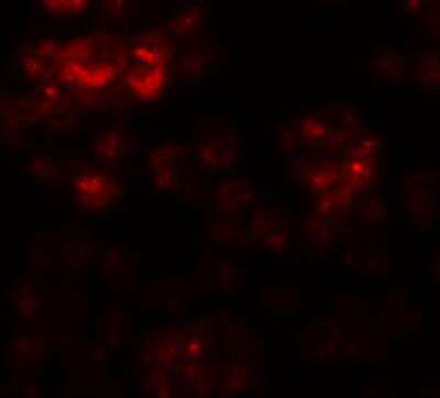 Immunocytochemistry/ Immunofluorescence: DYRK2 Antibody - BSA Free [NBP1-76560]