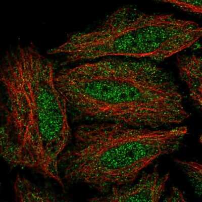 Immunocytochemistry/ Immunofluorescence: DYRK3 Antibody [NBP2-57912]