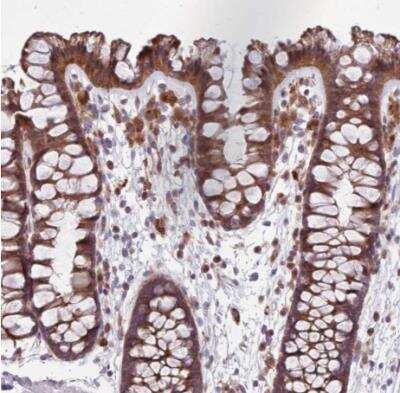 Immunohistochemistry-Paraffin: DYSFIP1 Antibody [NBP2-13801]