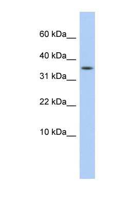 Western Blot: DYSFIP1 Antibody [NBP1-55526]