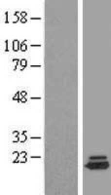 Western Blot: DYSFIP1 Overexpression Lysate [NBL1-10079]