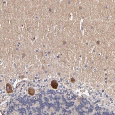 Immunohistochemistry-Paraffin: Dact1 Antibody [NBP1-85308]