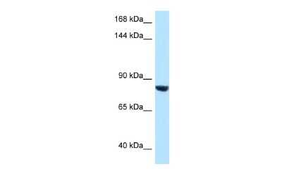 Western Blot: Dact1 Antibody [NBP2-84759]