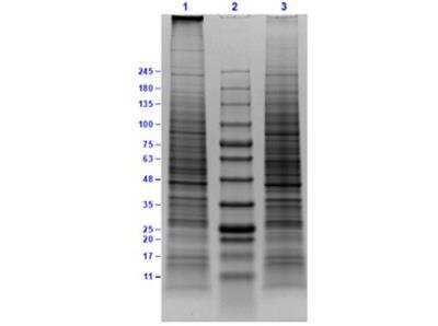 SDS-PAGE: Daudi Whole Cell Lysate [NBP3-05285]