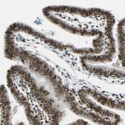 Immunohistochemistry-Paraffin: Daxx Antibody [NBP1-85309]