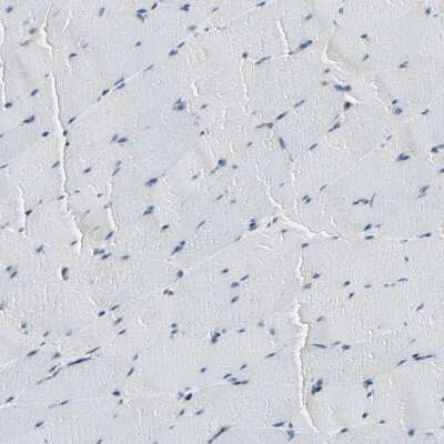 Immunohistochemistry-Paraffin: Daxx Antibody [NBP1-85309]