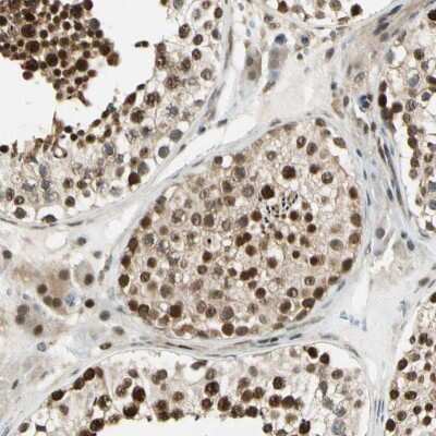 Immunohistochemistry-Paraffin: Daxx Antibody [NBP1-85309]