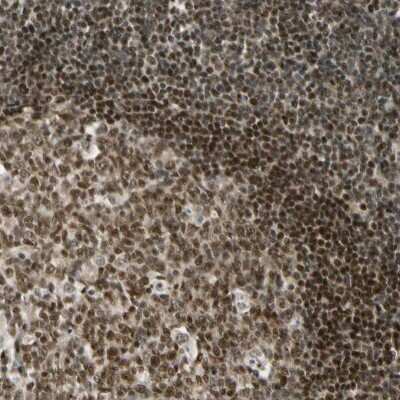 Immunohistochemistry-Paraffin: Daxx Antibody [NBP1-85309]