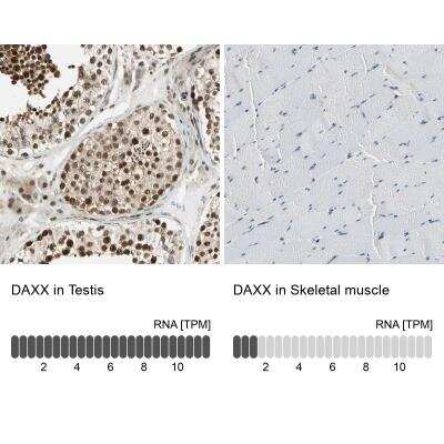 Immunohistochemistry-Paraffin: Daxx Antibody [NBP1-85309]