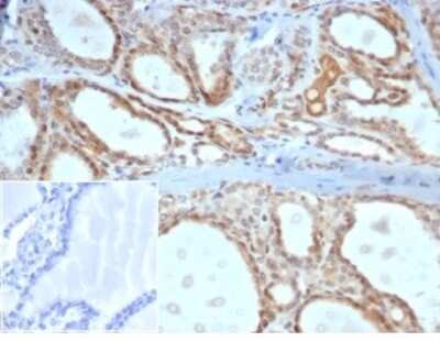 Immunohistochemistry-Paraffin: Daxx Antibody (PCRP-DAXX-5G11) [NBP3-13861]