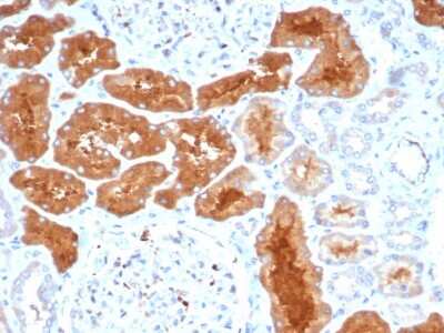 Immunohistochemistry-Paraffin: Daxx Antibody (PCRP-DAXX-8C2) [NBP3-07839]