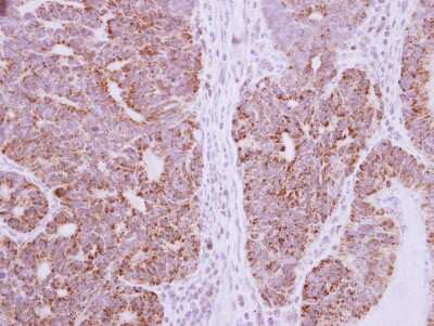 Immunohistochemistry-Paraffin: DcR3/TNFRSF6B Antibody [NBP2-16113]