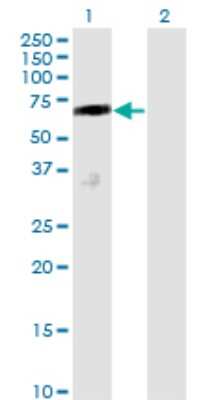 Western Blot: Dcp1a Antibody (2D12) [H00055802-M01]