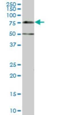 Western Blot: Dcp1a Antibody (2G10) [H00055802-M07]