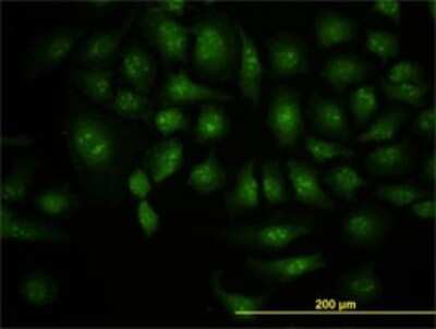 Immunocytochemistry/ Immunofluorescence: Dcp1a Antibody (3G4) [H00055802-M06]