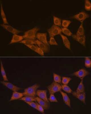 Immunocytochemistry/ Immunofluorescence: Dcp1a Antibody (7Q8Q6) [NBP3-16644]