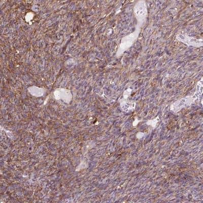Immunohistochemistry: Decorin Antibody [NBP2-56346]